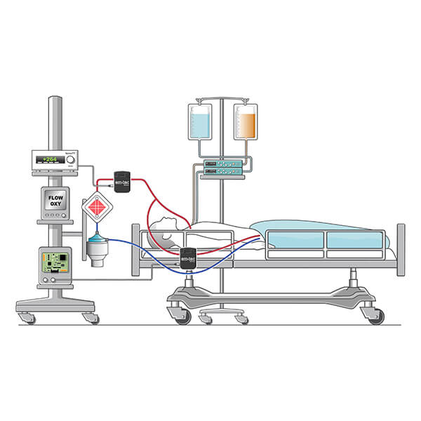 em-tec_MEDICAL_ECMO_Illustration_news